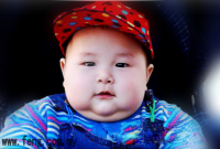 小孩肥胖1feng